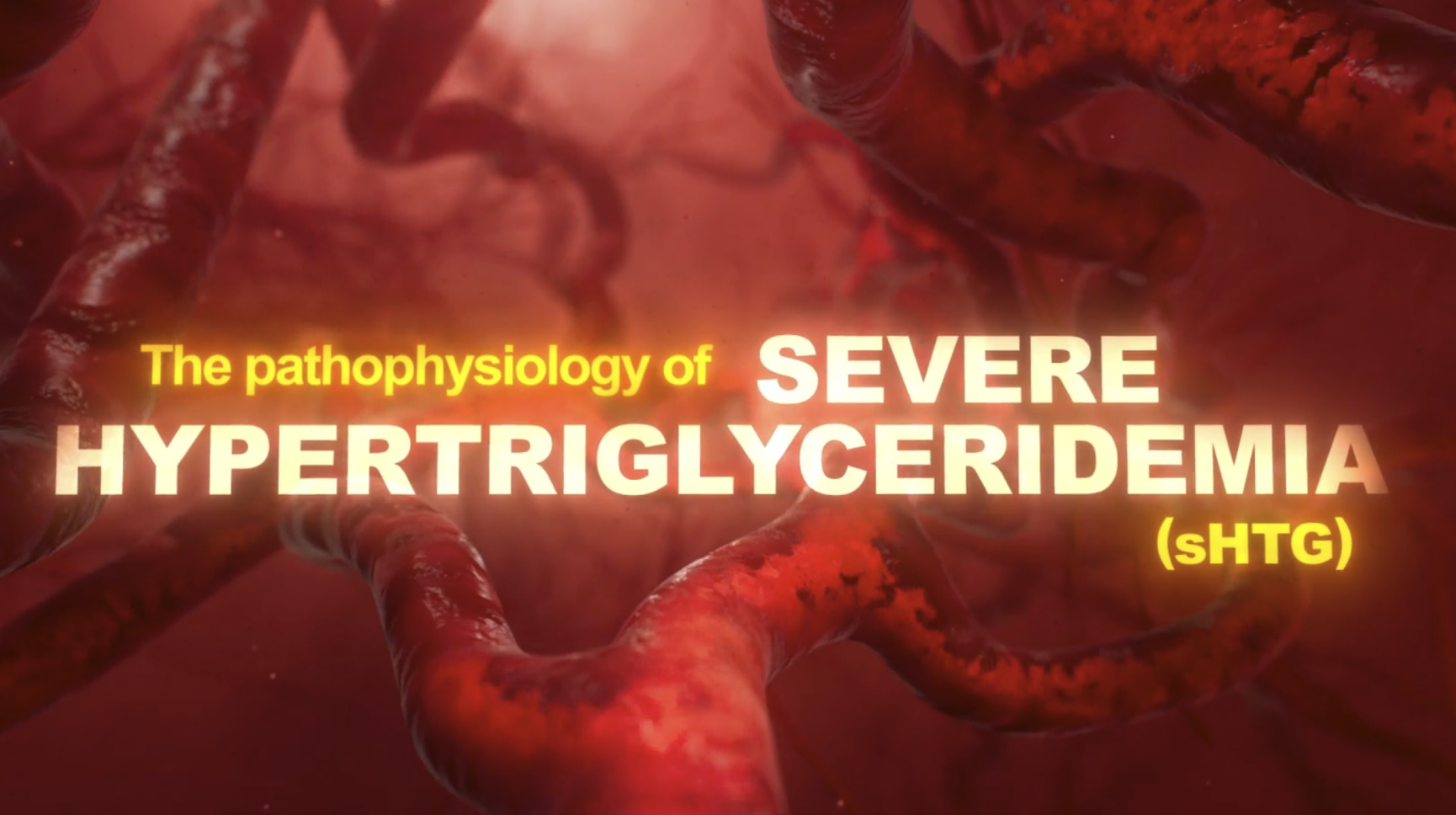 Video showing the pathophysiology of severe hypertriglyceridemia (sHTG)