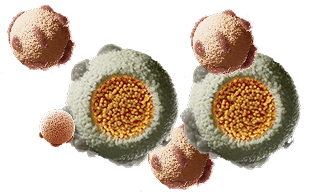 Lipoprotein visualization at triglyceride levels between 500 mg/dL and 880 mg/dL