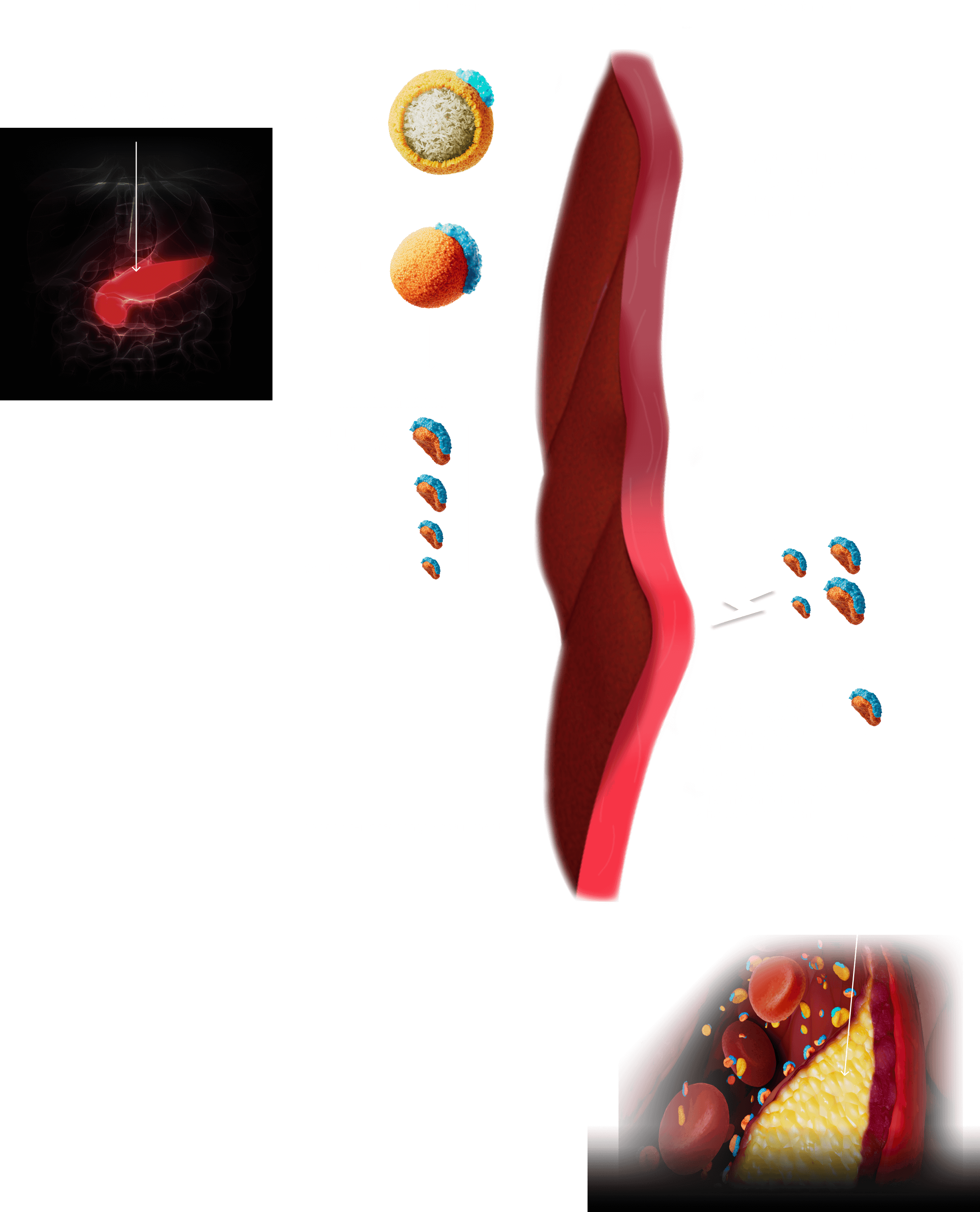 Biologic mechanisms of TRL-related atherosclerosis